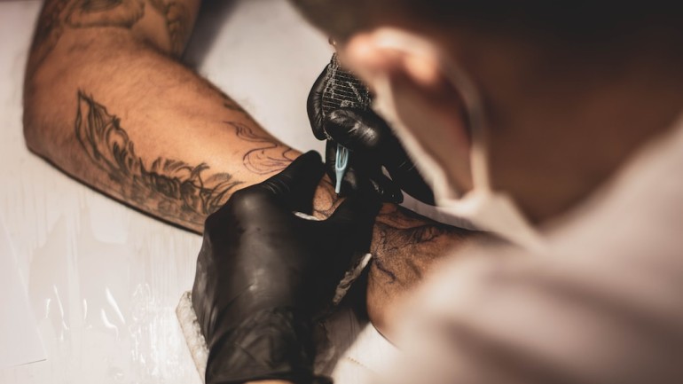 Usuwanie tatuażu — Jak pozbyć się niechcianego wzoru z Twojej skóry?